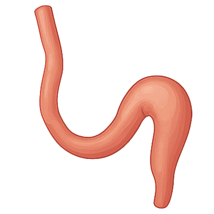 appendix แปลว่า ไส้ติ่ง