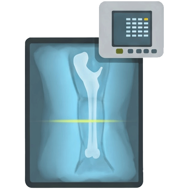 ray แปลว่า รังสี