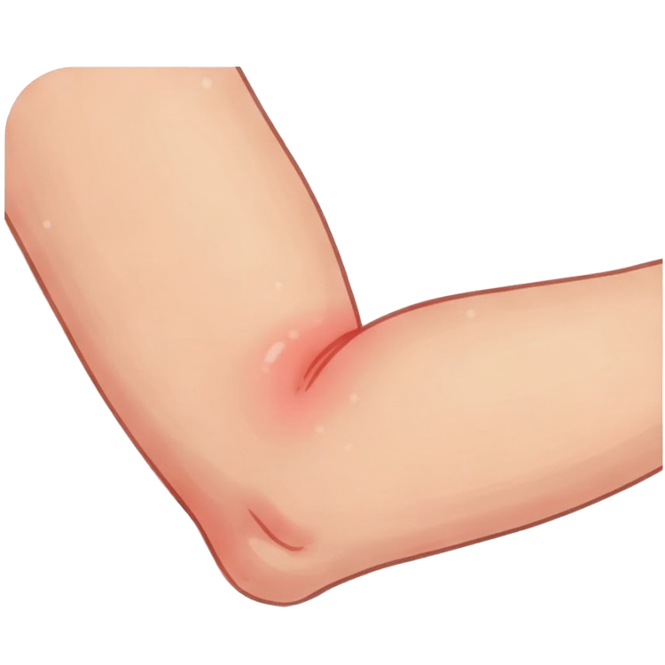 swelling แปลว่า การบวม