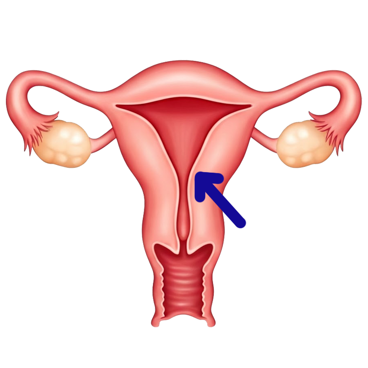 uterus แปลว่า มดลูก