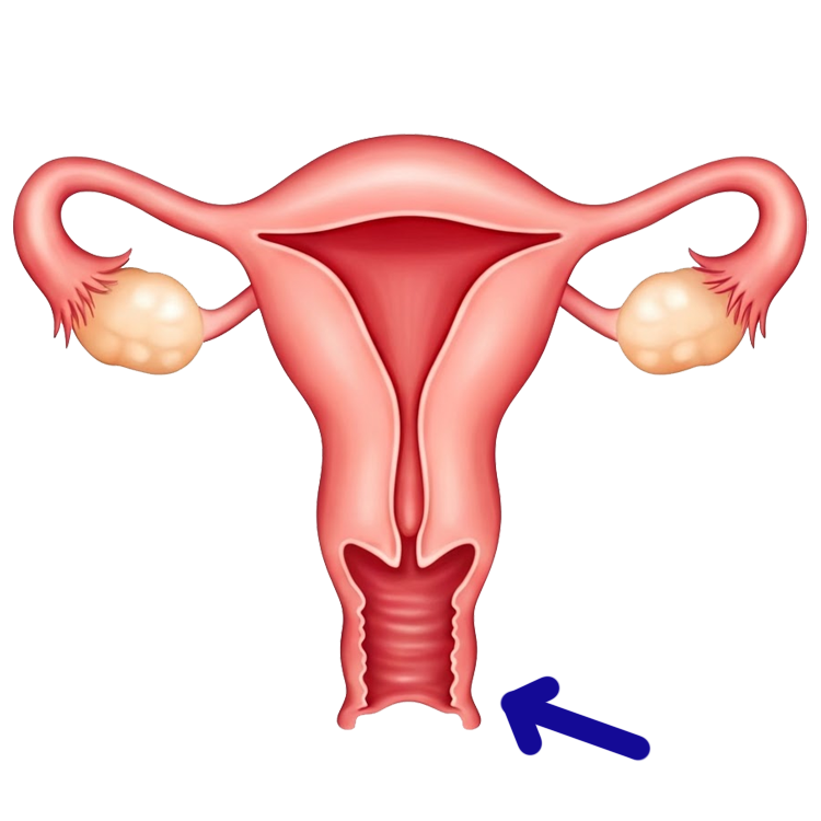 vagina แปลว่า ช่องคลอด