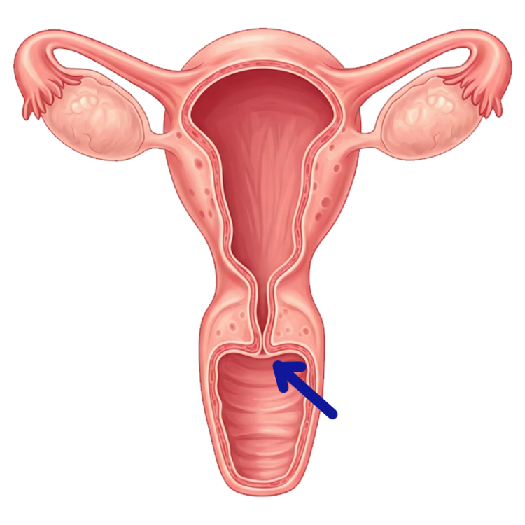 cervix แปลว่า ปากมดลูก