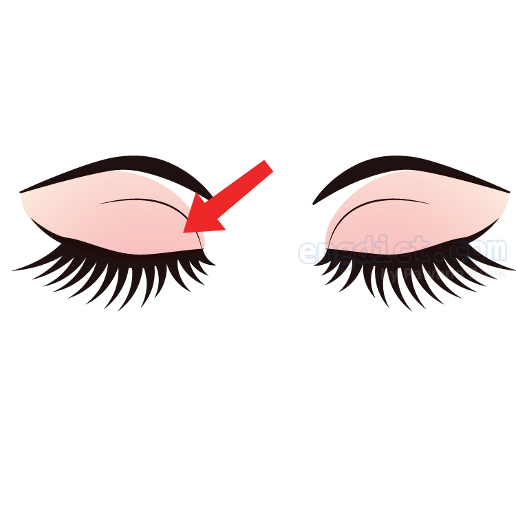 eyelid แปลว่า เปลือกตา